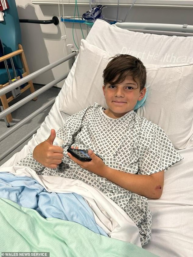 Theo Scarpato (seen), 11, was bitten on the leg by an XL Bully as he tried to distract the dog from his younger siblings. His mother Tina, 41, called him a 'true hero'