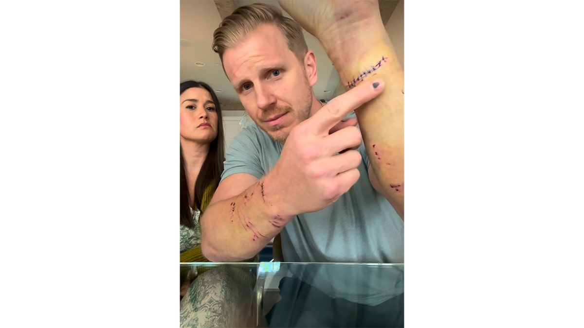 Sean Lowe shares injuries after being attacked by dog