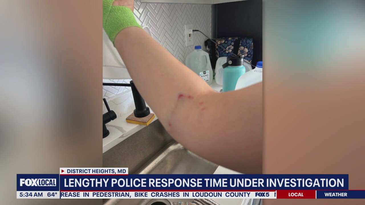 Police response time under investigation following dog attack